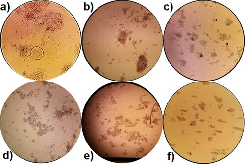 Figure 5. Images from the microscopic analysis of the activated sludge (100Х) in Variant I (without P. aureofaciens AP-9) at: (a) 24 h, (b) 48 h and (c) 72 h; and in Variant II (with P. aureofaciens AP-9) at: (d) 24 h, (e) 48 and (f) 72 h.