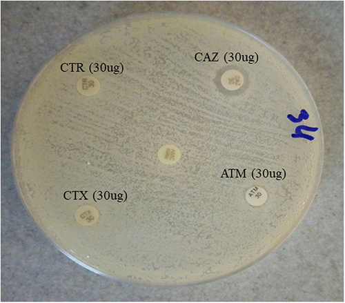 Figure 1 Petri dish with a strain of E. coli resistant to CRO, CAZ, CTX, ATM.