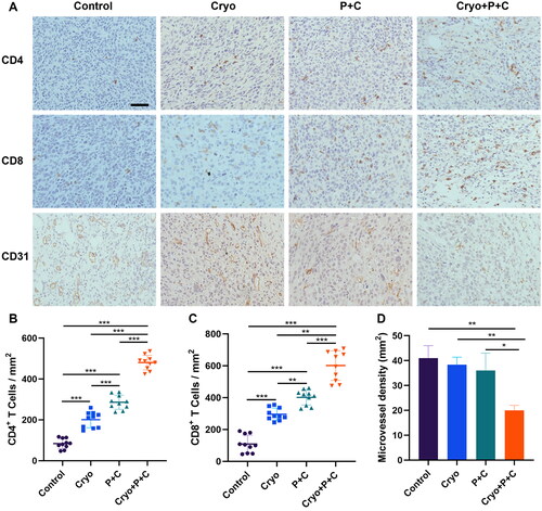Figure 6. Cryo And PD-1/CTLA-4 monoclonal antibody combination therapy (Cryo + P + C) promotes intratumoral infiltration of T lymphocytes. A. Representative micrographs of CD4+ cells, CD8+ cells, and CD31+ cells in the control, Cryo, P + C and Cryo + P + C groups at 200× magnification. The cellular nuclei exhibited a blue coloration when observed under the microscope, whereas the outcome of the positive test was characterized by a brown hue. Bars = 50 µm. B–D. From each slide, 10 fields were selected randomly for analysis. N = 3.