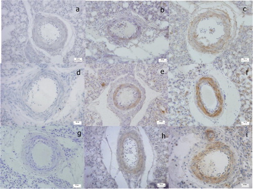 Figure 2. Immunohistochemical analysis of MIF, p-ERK and cyclinD1 in broiler lungs (Bar = 20 µm). Immunostaining with antibody to MIF, p-ERK and cyclinD1 in healthy lungs (b, e, h), compared with lungs from the PH group (c, f, i). The negative control received PBS (a, d, g).