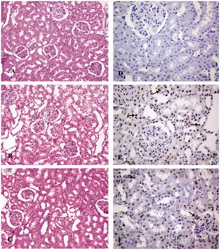 Figure 1. Photomicrographs illustrate morphological (H&E, ×200) (A–C) and apoptotic (active caspase-3, ×400) (D–F) changes in rat kidney. Control group (A, D), cisplatin group (B, E), cisplatin + curcumin group (C, F). Caspase-3 immunopositive cells (arrows).