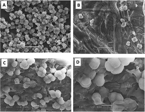 Figure 3. SEM analysis of non-treated control bacterial cells (A) and S. aureus treated with Ag-NPs formed by extracts from A. vera (B), P. oleracea (C) and C. dactylon (D).