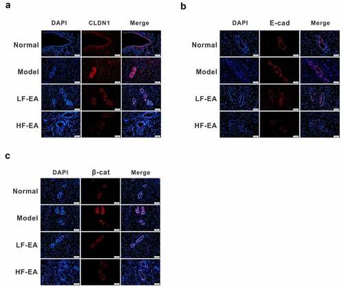 Figure 3. Expressions of Claudin, E-cadherin and β-catenin in rat endometrium were detected by immunofluorescence. (a) The levels of E-cadherin in endometrium of rats were detected by immunofluorescence. (b) Expressions of β-catenin in endometrium of rats were detected by immunofluorescence. (c) Expressions of CLDN1 in endometrium of rats were detected by immunofluorescence. Data are represented as mean ± SD (n ≥ 3 experiments). *p < 0.05, **p < 0.01, ***p < 0.001 and ****p < 0.0001 as determined using Student’s t-test (two groups) or one-way ANOVA, followed by Tukey’s test (more than two groups)