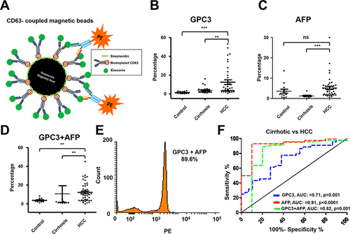 Figure 9 Performance of magnetic bead assay for HCC detection using antibodies to GPC3 alone, AFP alone, and a combination. (A). Illustrate the assay design. Streptavidin-conjugated magnetic beads were attached to a biotinylated CD63 antibody. The next day, beads were incubated with 10μL of the serum diluted in 100μL PBS with 1%BSA overnight. The next day, beads were washed twice and then incubated with PE-conjugated antibodies (GPC3 alone, AFP alone, and combination) for one hour. Following this step, beads were washed and analyzed by a flow cytometer. (B). Percentage of exosomes reacted with GPC3 antibody by magnetic bead-based flow assay in normal healthy serum, cirrhosis, and cirrhosis with HCC. (C). Percentage of HCC exosome captured using AFP antibody using magnetic bead-based flow assay between normal healthy serum, cirrhosis, and cirrhosis with HCC. (D). Percentage of HCC exosome captured using a combination of AFP and GPC3 antibodies in normal healthy serum, cirrhosis, and cirrhosis with HCC. Statistical significance levels were presented as ns for non-significant, ** for p<0.01, *** for p<0.001 (E). Representative flow cytometry image showing very high reactivity of HCC exosomes using the combination of two antibodies. (F). ROC analysis shows the sensitivity and specificity of immunomagnetic bead flow assay for HCC exosome quantification.