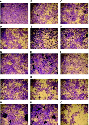 Figure 2. Antiviral activity of 13 probiotic samples against CVB3. HeLa cells were treated with cell extracts from various probiotic samples and the plaque reduction assay was conducted. HeLa cells were observed under a light microscope at ×200. (A) No infection; (B) CVB3 infection; (C) CVB3+SPM0212; (D) CVB3+SPM0214; (E) CVB3+SPM0308; (F) CVB3+SPM1005; (G) CVB3+SPM1604; (H) CVB3+SPM1605; (I) CVB3+SPM1608; (J) CVB3+SPM1204; (K) CVB3+SPM1309; (L) CVB3+SPM1205; (M) CVB3+SPM1206; (N) CVB3+SPM1207; (O) CVB3+SPM0211. At least three independent assays were performed.