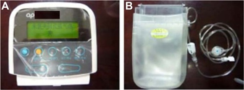 Figure 4 Driver (A) and drug container (B) of ambulatory infusion pumps for fluorouracil infusion.