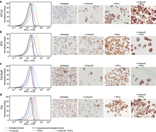 Figure 3. Pharmacological demethylation induces PD-L1 expression and enhances IFN-γ inducibility in urothelial cancer cells. Normalized histograms and PD-L1 IHC illustrate the induction of membranous PD-L1 expression in pharmacologically demethylated (5‐aza‐dC treated) urothelial cancer cell lines (a: RT112; b: RT4; c: TCCSUP; d: T24), with and without IFN-γ stimulation, compared to untreated.