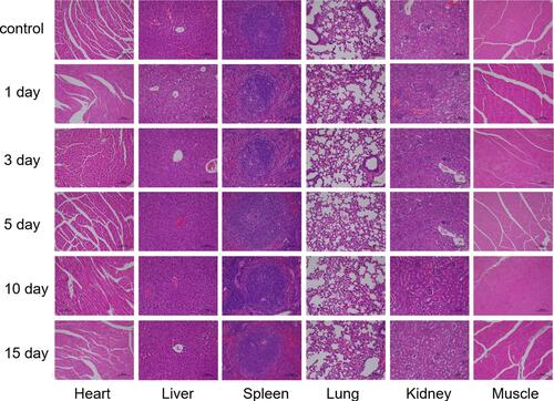 Figure 5 Hematoxylin and eosin (H&E) staining of important organs for normal mice at different time points after the injection of CuFeSe2-PEG-FA contrast agent and 5% glucose solution via the tail vein.