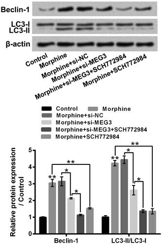 Figure 6. The silence of MEG3 suppressed HT22 cell autophagy through inactivating ERK pathway. Followed by 10 µM morphine treatment and/or si-MEG3 transfection or SCH772984 incubation, the Beclin-1 and LC3 protein levels in HT22 cells were tested by western blotting. MEG3: LncRNA maternally expressed gene 3. *p ˂ 0.05, **p ˂ 0.01.