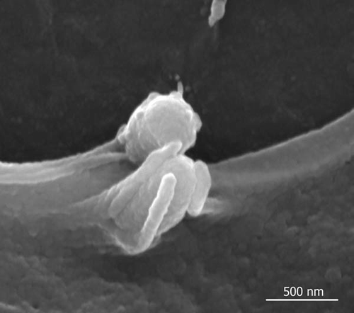 Figure 1 Entry of P. gingivalis into human gingival epithelial cells. Human gingival epithelial cells were incubated with P. gingivalis strain ATCC 33277 for 15 min and bacterial entry was observed using a scanning electron microscope. P. gingivalis is captured by cellular pseudopodia and internalized via an endocytic pathway.