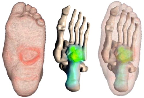 Figure 2. Visualization of strain clusters over 50%, and their location (yellow/green dots).