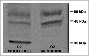 Figure 6 ZIP1 transporter western blot analysis of TRAMP C2 cells. 48 and 66 kDa bands are membrane-complexed forms of the transporter protein. 35 kDa is likely the free cytosolic protein.