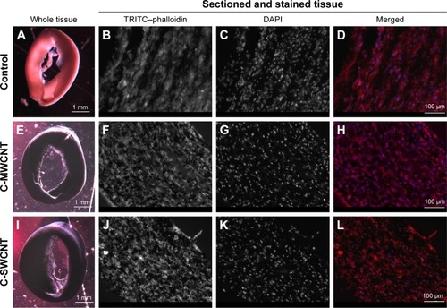 Figure 2 Fibroblasts formed ECT in vitro in the presence of C-SWCNTs and C-MWCNTs.Notes: (A, E, I) Bright-field images for intact ECT; (B, F, J) actin cytoskeleton of the fibroblasts stained with TRITC-phalloidin (red); (C, G, K) nuclei stained with DAPI (blue); (D, H, L) merged images from DAPI and TRITC-phalloidin.Abbreviations: ECT, engineered connective tissue; C-SWCNT, chitosan–single-wall carbon nanotube; C-MWCNT, chitosan–multi-wall carbon nanotube; TRITC, tetra-methylrhodamine.