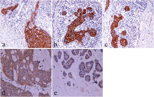 Figure 3.  Down-regulation of HER2 by HA6722 in vivo. Each treatment group was consisted of seven mice. Tumors from those mice surviving the entire treatment period were excised and photographed. (A) Blank group; (B) T (M) group; (C) TScr (M) group; (D) HA (M) group; (E) THA (M) group.