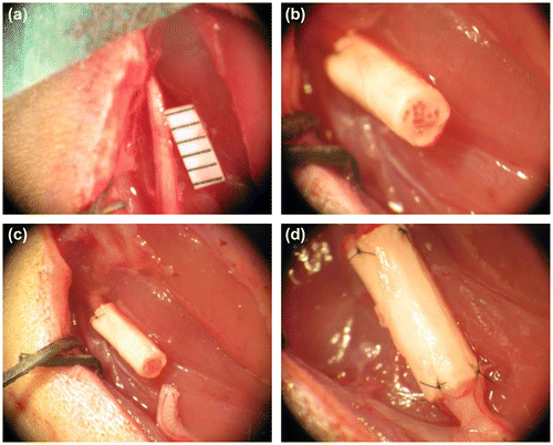 Figure 1. In vivo implantation of the NGF/CNTF-functionalized silk implant for sciatic nerve reconstruction. A 5 mm sciatic nerve section is removed on the right leg of the rat (a), the implant is first sutured to the proximal end of the nerve (b), the scaffold is carefully placed in front of the distal extremity of the sectioned sciatic nerve (c) and then sutured without turning the nerve (d).