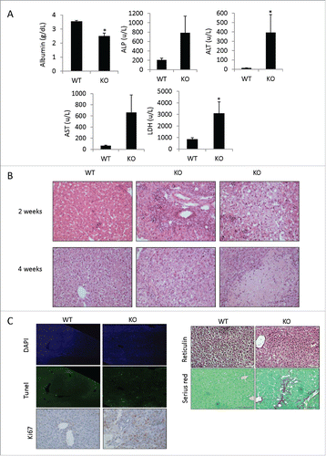 Figure 2. Adar Hep-KO mice show extensive liver damage with fibrogenesis. (A) Impaired level of liver enzymes detected in serum of 4-week old Adar Hep-KO mice: decreased levels of albumin, and increased levels of alkaline phosphatase (ALP), alanine aminotransferase (ALT), aspartate aminotransferase (AST) and lactate dehydrogenase (LDH) were detected in the Adar Hep-KO mice indicative of hepatocellular damage (n = 4). (B) H&E staining of representative liver sections from 2 and 4-week old Adar Hep-KO (KO) and WT control (WT) mice (n = 5). While the WT section exhibit normal characteristics the livers from the Adar Hep-KO mice show massive damages to the tissue (x40 magnification). (C) Analysis of representative liver section from 4-week old Adar Hep-KO and WT mice using specific staining to detect apoptosis (TUNEL assay, x10 magnification), compensatory proliferation (Ki67, x20 magnification), changes in liver architecture (Reticulin, x40 magnification) and hepatic fibrosis (Serius Red, x40 magnification).