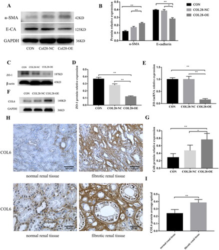 Figure 4. Effect of overexpression of COL28 on the expression of E-cadherin and α-SMA protein in HK-2 cells after induction with 10 ng/ml TGF-β1 (A-B). *p < 0.05 **p < 0.01. Overexpression of COL28 in HK-2 cells inhibited ZO-1 protein (C-D) and mRNA (E) expression. **p < 0.01. COL6 protein expression levels in the CON, COL28-NC, and COL28-OE groups (F-G). *p < 0.05 **p < 0.01. COL6 protein expression in human fibrotic renal tissue was higher than in human normal renal tissue (H, I). **p < 0.01. All experiments were performed three times.