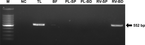 Figure S2 Comparison of rotavirus adsorption on anti-rotavirus antibody-integrated magnetic beads and magnetic beads not loaded with antibody.Notes: Rotavirus-infected cell lysate (10 µL) was diluted with PBS (500 µL) and then incubated for 5 minutes at room temperature with either anti-rotavirus antibody-integrated magnetic beads or “plain” beads not loaded with antibody (ie, amine groups on their surface but lacking antibody). After incubation, the following fractions were obtained: 1) diluted rotavirus sample before incubation with the beads (BF), 2) supernatant fraction after incubation with “plain” beads (PL-SP), 3) bead fraction after incubation with “plain” beads (PL-BD), 4) supernatant fraction after incubation with the anti-rotavirus antibody-integrated MNBs (RV-SP), 5) bead fraction after incubation with anti-rotavirus antibody-integrated MNBs (RV-BD), and 6) total sample containing the same quantity of rotavirus as in 10 µL of rotavirus-infected cell lysate (total fraction, TL). Viral genomic RNA was subsequently extracted from each fraction using a QIAamp Viral RNA mini kit and subjected to a RT-reaction. The diluted cDNA was amplified in a reaction mixture containing Ex Taq (Takara Bio Inc.) and Ex Taq buffer as well as primers recognizing rotavirus VP7 performing 25 cycles of temperature cycling at 94°C for 1 minute, 60°C for 1 minute, and 72°C for 1 minute. Rotavirus VP7 gene (552 bp) in the cDNA was amplified by PCR as described in Materials and methods. PCR products were analyzed by agarose gel electrophoresis (1.2% gel). The identity of the amplified products was subsequently confirmed by DNA sequencing. The left-hand lane is size marker (M), which includes DNA of 100, 200, 300, 400, 500, 600, 700, 800, 900, 1,000, 1,200, and 1,500 bp. The position of the 552 bp band for VP7 is indicated by an arrow. As a negative control (NC), a water sample (ie, no rotavirus) was also subjected to RT-PCR.Abbreviations: MNBs, magnetic nanobeads; RT, reverse transcription.