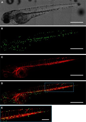 Figure 2 Distribution of zebrafish macrophages and gelatin nanospheres at 3 hours after intravenous injection of gelatin nanospheres into a 3-day-old zebrafish larva. (A) Bright field image; (B) green fluorescent macrophages; (C) red fluorescent gelatin nanospheres; (D) merged image of (B) and (C) with co-localization of gelatin nanospheres and macrophages depicted in yellow. Several macrophages co-localized with gelatin nanospheres in the caudal blood vessel of the larva (blue dashed box in D). Scale bars represent 500 μm. (E) Magnification of the boxed area in (D). Scale bar represents 200 μm.