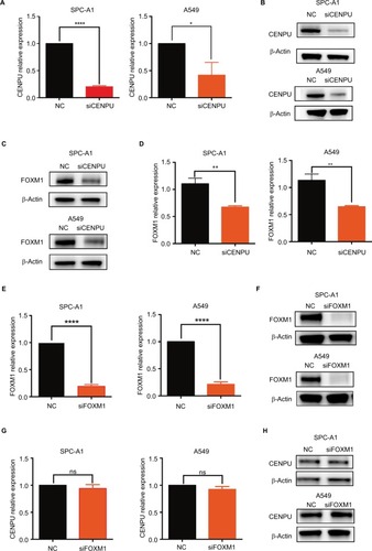 Figure 4 Knockdown of CENPU inhibits FOXM1 expression in lung cancer cells.Notes: (A) Quantitative reverse transcription results showed that the mRNA expression of CENPU was downregulated in the siCENPU group compared with that expression in the NC group in SPC-A1 and A549 lung cancer cells. (B) Western blotting showed that the expression of CENPU declined 48 hours after siCENPU transfection in SPC-A1 and A549 cells. (C) Western blotting showed that the protein expression of FOXM1 was significantly downregulated in the siCENPU group. (D) Relative protein levels of FOXM1 were determined by Western blotting. The protein levels of FOXM1 were normalized to those of β-actin. (E) Quantitative reverse transcription PCR results showed that the mRNA expression of FOXM1 was downregulated in the siFOXM1 group compared with that expression in the NC group. (F) Western blotting showed that the expression of FOXM1 protein declined 48 hours after siFOXM1 transfection. (G) Knockdown of FOXM1 did not affect the mRNA expression level of CENPU, which was determined by RT-qPCR. (H) Western blotting showed that the expression of CENPU protein was not changed in the siFOXM1 group in both SPC-A1 and A549 cells; ***P<0.001; **P<0.01; and *P<0.05 (mean ± SEM).Abbreviations: CENPU, centromere protein U; FOXM1, Forkhead box protein M1; NC, negative control; NS, no significance; RT-qPCR, real-time quantitative PCR; SEM, standard error of the mean; siCENPU, CENPU siRNA; siFOXM1, FOXM1 siRNA.