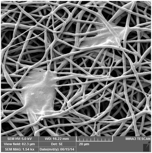 Figure 4. IPFP-ASCs attached to the PCL scaffold as seen by scanning electron microscope, 1.54K×.