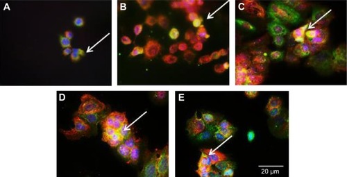 Figure 7 Colocalization of β1-integrin and pFAK.Notes: Immunofluorescence staining of β1-integrin of cells cultured on (A) (f)pMAand (B) (−)pMA imprint; and on (C) (f)pST, (D) (−)pST, and (E) (+)pST imprints. β1-integrin was localized using mouse anti-β1-integrin, and pFAK was localized with rabbit anti-pFAK, which were then imaged with AlexaFlour 488 (green) and Atto 594 (red), respectively. Colocalization of β1-integrin and pFAK is indicated by the arrows, where merging of green and red tags to yellow coloration occurs. Cell nuclei were stained with Hoechst 33342 (blue) (original magnifications: ×20).Abbreviations: (−), negative imprint; (+), positive imprint; (f), flat substrate; pFAK, phosphorylated focal adhesion kinase; pMA, polymethacrylate; pST, polystyrene.