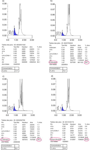 Fig. 1 Chromatograms from samples of diabetic patients without and with hemoglobin variants (HPLC D-10). (a) sample without hemoglobin variant; (b) sample with HbS; (c) sample with HbC; (d) sample with hemoglobin variant not recognized.