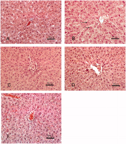 Figure 1. Histology of liver tissues. Samples were isolated from dams in each experimental group and processed and analyzed as noted in the methods. Representative slides from each group of animals is shown. (A) Control (peanut oil), (B) Aroclor 1254 (10 mg/kg) only, (C) Aroclor + 75 mg/kg quercetin, (D) Aroclor + 150 mg/kg quercetin, and (C) Aroclor + 300 mg/kg quercetin. Arrows indicate lipid droplet(s) presence. Hematoxylin-eosin (HE); magnification = 200×.