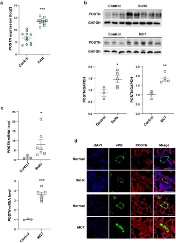 Figure 1. Upregulation of POSTN in the lung tissue of patients with PAH and PAH animal models.: a, POSTN mRNA level in the lung tissue of patients with PAH from public GEO dataset (GSE53408). b, Protein and c, mRNA expression of POSTN in the lung tissue of SuHx and MCT rat models. d, Representative images of POSTN/vWF co-localization in the lung tissue of SuHx and MCT rat models. Lung sections were stained for POSTN (red), vWF (green) and DAPI (blue). Scale bar = 50 µm. * P < 0.05, ** P < 0.01, *** P < 0.001 determined by the unpaired two-tailed Student’s t-test. Error bars, S.E.M.