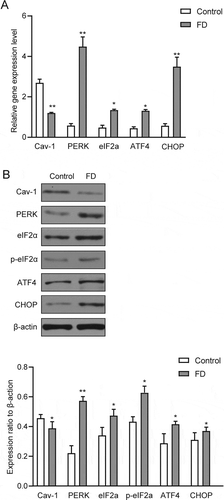 Figure 5. Folic acid deficiency could downregulate the Cav-1 expression and activate PERK in vitro. (A) RT-qPCR analysis of Cav-1, PERK, eIF2a, ATF4 and CHOP in GC-2 cells. (B) Western blot analysis of Cav-1, PERK, eIF2a, p- eIF2a, ATF4 and CHOP in GC-2 cells. All experiments were performed n = 6 in replicates. Data were presented as mean ± SEM, *P < 0.05, **P < 0.01
