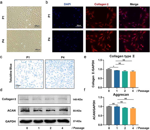 Figure 2. Culture and identification of rat nucleus pulposus (NP) cells. (a) The NP cells of passage 1 and 4; (b) Immunofluorescence analysis for collagen type II of NP cells of passage 1 and 4; (c) Toluidine blue staining for aggrecan of NP cells of passage 1 and 4; (d) Western blotting analysis for the expression of collagen type II and aggrecan of NP cells of passage 1 and 4; (e-f) The quantitative and statistical analysis of the western blot band (Aggrecan, and Collagen type II)