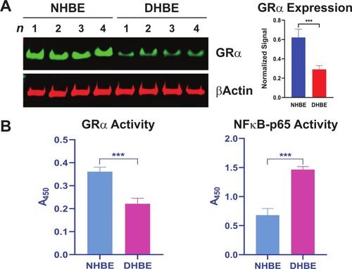 Figure 1 Reduced GRα expression and activity in COPD HBE cells. (A) GRα expression in DHBE (also described as COPD HBE in the text) and NHBE cells, determined by Western blotting and quantified by densitometric analysis. β-Actin served as a loading control. (B) DNA-binding activities of GRα and NF-κB p65 in NHBE and DHBE cells. Data are expressed as means ± SD. n = 4; ***P < 0.001.