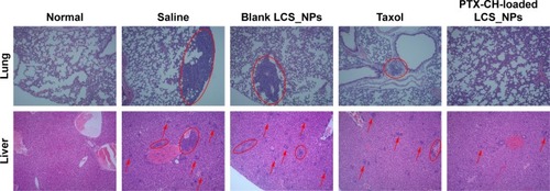 Figure 11 Lungs and livers of normal and tumor-bearing mice treated with saline, blank LCS_NPs, PTX, PTX-CH-loaded LCS_NPs were stained with H&E and observed by optical microscope, 100×. Normal lungs and livers were taken as a comparison; circled areas and red arrows show the metastatic areas.Abbreviations: LCS_NPs, lecithin–chitosan nanoparticles; PTX-CH-loaded LCS_NPs, paclitaxel–cholesterol complex-loaded lecithin–chitosan nanoparticles.