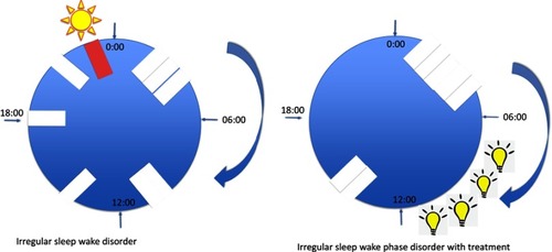 Figure 3 Management of irregular sleep–wake phase disorder.