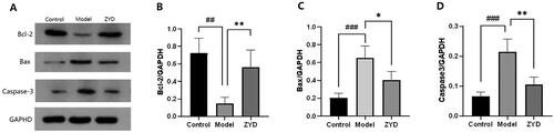 Figure 10. (A) Western blotting was used to detect the expression of Bcl-2, Bax and Caspase3 proteins in mice. (B–D) The level of relative expression of Bcl-2, Bax, and Caspase3. ##p < .01 and ###p < .001 compared with the control group. *p < .05 and **p < .01 compared with the model group.
