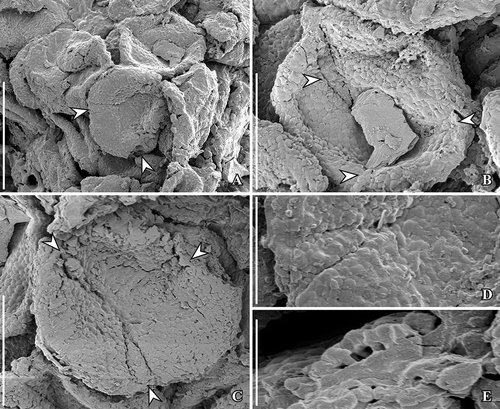 Figure 4. Kajanthus lusitanicus gen. et sp. nov. from the Early Cretaceous Chicalhão site, Juncal village, Portugal; holotype (P0093). SEM micrographs of in situ tricolpate pollen grains. A. Group of strongly flattened and somewhat folded pollen grains inside the broken pollen sac; two apertures in one grain are marked with arrowheads. B, C. Pollen grains in polar view showing the circular shape, triaperturate organisation, perforate-punctate pollen wall and verrucate aperture membrane; apertures are marked with arrowheads. D. Detail of pollen grain showing the verrucate colpus membrane and perforate-punctate, non-striate surface of the pollen wall. E. Fragmented pollen grain showing tectum supported by scattered columellae. Scale bars – 20 µm (A), 10 µm (B, C), 5 µm (D), 2 µm (E).