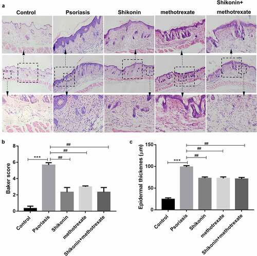 Figure 2. Shikonin combined with methotrexate reduced backer score and epidermal thickness in imiquimod-induced psoriasis mice. The skin lesion tissue from mice in Control, psoriasis, shikonin, methotrexate and shikonin + methotrexate groups was isolated, stained by hematoxylin-eosin and optically photographed (a). The statistical data showed the backer score (b) and epidermal thickness (c) from (A). ***p < 0.001 vs. Control group. ##p < 0.01 vs. psoriasis group.