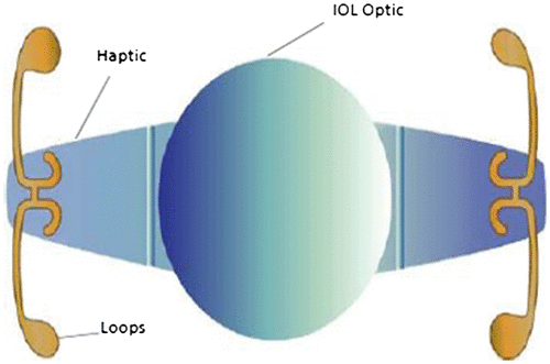 Figure 13. CrystaLens accommodating IOL. Source: https://www.researchgate.net/figure/7017218_Fig1_Figure-1-The-Crystalens-AT-45-accommodating-IOL-A-posterior-chamber-modified [accessed Jun 15, 2016].