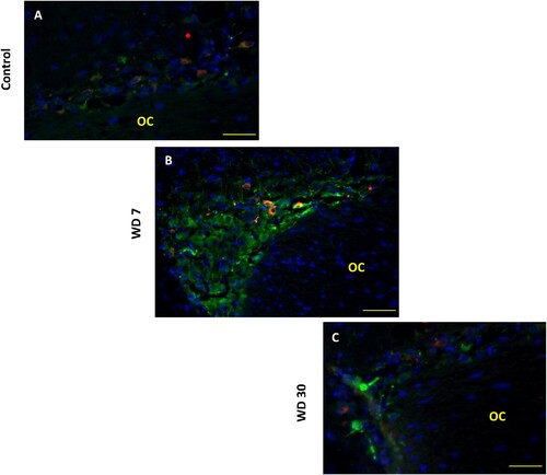 Figure 5. Double immunofluorescence staining in the frontal sections through the hypothalamus of Meriones libycus shows vasopressinergic (NP/AVP, green) and oxytocinergic (OT, red) neurons and nuclei (DAPI, blue) of the SON in control group (A), 7 days WD group (B) and 30 days WD group (C). NP/AVP colocalizes with OT (orange). OC: optic chiasm. Scale bar: 100µm