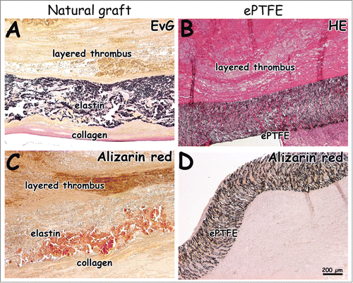 Figure 6. Histological images 4 weeks after surgery. Natural grafts show occlusion with layered thrombi characterized by lines of Zahn (A, C). One ePTFE graft was found to be occluded (B). Calcification was seen in the natural graft located in the elastin layer (C, D, alizarin red staining). Bar represents 200 µm.
