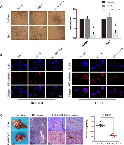 Figure 3 RNA interference of CD276 inhibited VM formation of HCC cell lines in vitro and in vivo. (A) The 3D VM formation assay was performed to analyze the formation of the vascular-like tube in HCC cells. The representative images and the quantification of the results are presented as mean ± SD; scale bar, 200μm (*p< 0.05); (B) Immunofluorescence analyses showed that CD276 knock-down decreased the expression of VE-cadherin in Bel7404 and Huh-7cells; Scale bar represents 50 μm. Original magnification: 400×; (C) CD276 knock-down inhibited VM formation in an orthotopic transplant mouse model of HCC cells. The letter “T” represents tumor tissue and “N” represents normal liver tissue. The black arrows indicate blood vessels formed by endothelial cells (PAS-/CD31+) and the red arrows indicate the VM vessel (PAS+/CD31-). In addition, CD276 knock-down also led to a reduced tumor weight. The representative images and the quantification of the results are presented as mean ± SD (*p< 0.01).