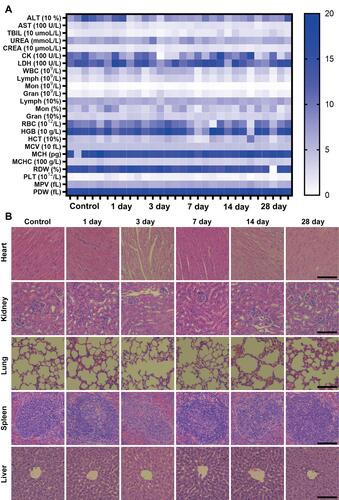 Figure 11 Biosafety of FBPD NPs. (A) Assay of blood index after i.v. injection of FBPD NPs (n = 5). (B) Images of H&E stained slices of major organs (scale bar = 50 µm).