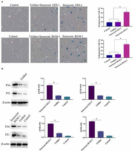 Figure 7. (a). the senescence-associated β-galactosidase (SA β-gal)-positive cell ratio were significantly reduced by uridine treatment. (b). The senescence-related markers (p16, p21 and p53) were down-regulated by uridine treatment. (c). MTT assay indicated that the uridine treatment increased cell proliferation ability of the senescent GES-1 and RGM-1 cell. (d). uridine treatment effected the cell cycle. The data are shown as means ± SEM. Asterisks indicate significant differences (P < 0.05).