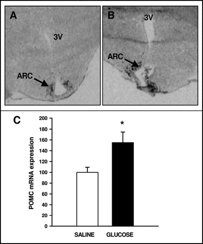 Figure 2 Autoradiographs depicting the distribution of POMC mRNA expression in the fetal ARC in saline infused (A) and glucose infused (B) fetuses at 140 ± 1 d gestation (term ∼150 d gestation). (C) The effect of glucose infusion on the expression of POMC mRNA in the fetal arcuate nucleus. * denotes p < 0.05 compared to the saline infused fetuses. ARC: arcuate nucleus, 3V: third ventricle.