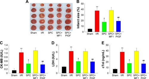 Figure 3 Pretreatment with 2.5% sevoflurane limits the myocardial infarct size and reduces cardiac enzyme release.