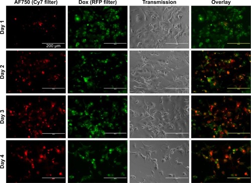 Figure 16 Enzymatic activation of fluorescence and Dox-FB delivery to cells over 96 hours.Notes: Individual channel and overlay images of MDA-MB-231 cells exposed to Dox-FB-AF750 NPs with PLGA-PLL copolymer at 0.2 mg/mL (10 µM Dox-FB). Red indicates AF750 and green Dox-FB.Abbreviations: AF, Alexa Fluor; Dox, doxorubicin; FB, free base; NPs, nanoparticles.