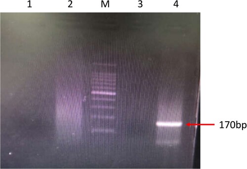 Figure 3. PCR amplification of Acanthamoeba and Balamuthia DNA using the specific primers, BalaF1451 and BalaR1621. M: 100-bp DNA ladder; Lane 1: negative control detecting Acanthamoeba; Lane 2: patient’s sample detecting Acanthamoeba; Lane 3: negative control detecting Balamuthia; Lane 4: patient’s sample detecting Balamuthia