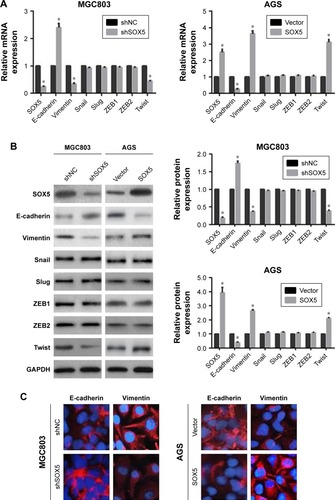 Figure 5 Detection of SOX5 and EMT-related marker expression in SOX5-altered GC cells.Notes: Following SOX5 silencing or overexpression treatment, qRT-PCR (A), Western blot (B) and immunofluorescence (C) were employed to detect the expression of SOX5 and EMT-related markers (E-cadherin, vimentin, Snail, Slug, ZEB1, ZEB2 and Twist) in SOX5-depleting MGC803 cells and SOX5-overexpressing AGS cells. *P<0.05. Magnification ×400.Abbreviations: SOX5, sex-determining region Y-box protein 5; EMT, epithelial–mesenchymal transition; GC, gastric cancer; qRT-PCR, quantitative real-time PCR; GAPDH, glyceraldehyde-3-phosphate dehydrogenase.