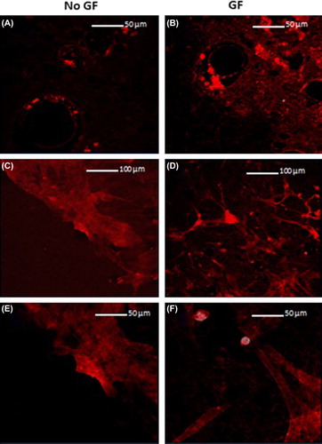 Figure 2. Phalloidin conjugate stain (confocal microscopy analysis). (A–B) 3 days at 20 × magnification. (C–D) 21 days at 10 × magnification. (E–F) 21 days at 20 × magnification.