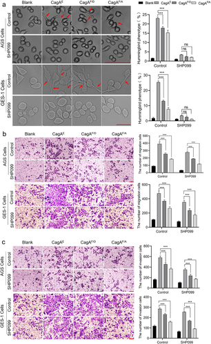 Figure 9. Role of residue Phe in EPIYA-D motif in affecting the oncogenicity of CagAE. SHP099 was used as an inhibitor to exclude the effect of interaction between SHP2 and CagA, as Phe in EPIYA-D motif was also reported to play roles in SHP2-CagAE interaction to improve the cytotoxicity of CagAE. (a) Examination of CagA induced specific hummingbird phenotype. Elongated cells with the longest axis exceeding the shortest axis by more than 2-fold were counted as the hummingbird phenotype. (b) Migration and (c) invasion of infected AGS and GES-1 cells examined by transwell assays. Bars in images represent 100 µm. Left, representative images; Right, statistical data. Error bars represent means ± SD, ns indicates no statistical significance, ***indicates p < 0.001.